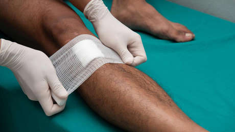 Una mujer se infecta con la bacteria 'comecarne' tras nadar en una playa en Florida