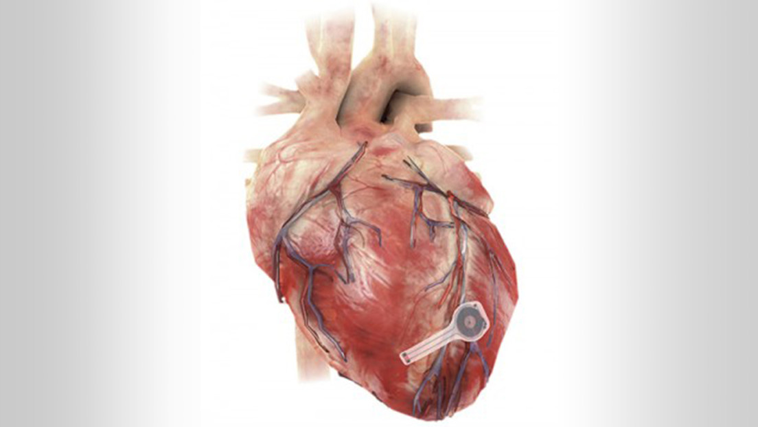Investigadores crean el primer marcapasos sin cables ni baterías que se biodegrada cuando ya no es necesario