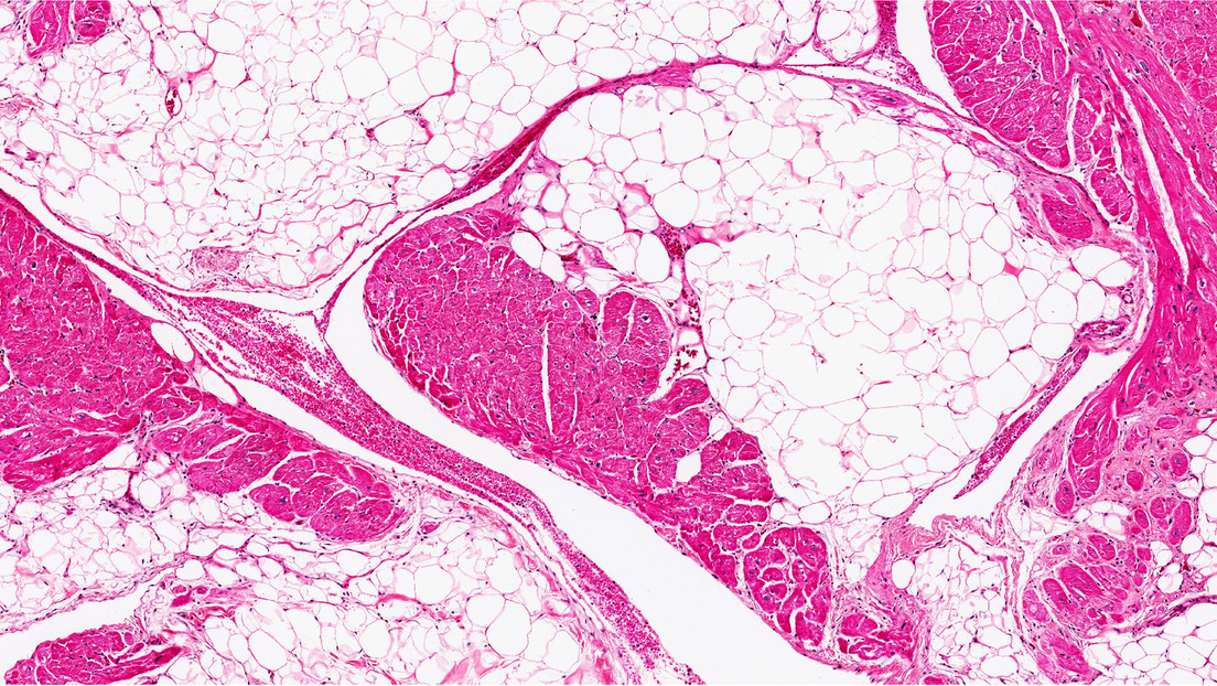 Una forma de perder peso 'sudando' grasa sin dieta ni ejercicios es descubierta accidentalmente durante experimentos con ratones