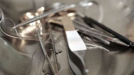 Un cirujano británico que 'firmó' los hígados de dos pacientes al operarlos podría enfrentar un castigo mayor que la suspensión por 5 meses