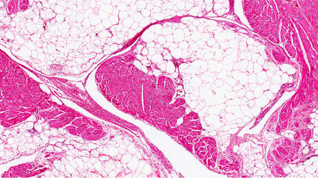 Una forma de perder peso 'sudando' grasa sin dieta ni ejercicios es descubierta accidentalmente durante experimentos con ratones