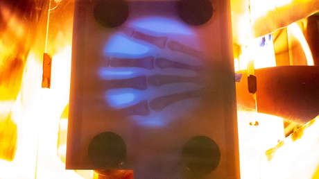 Un 'youtuber' de EE.UU. decide fabricar su propia máquina de rayos X tras recibir una factura de hospital de casi 70.000 dólares