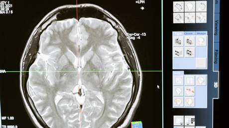 Samsung propone "copiar y pegar" la estructura del cerebro para crear chips neuromórficos