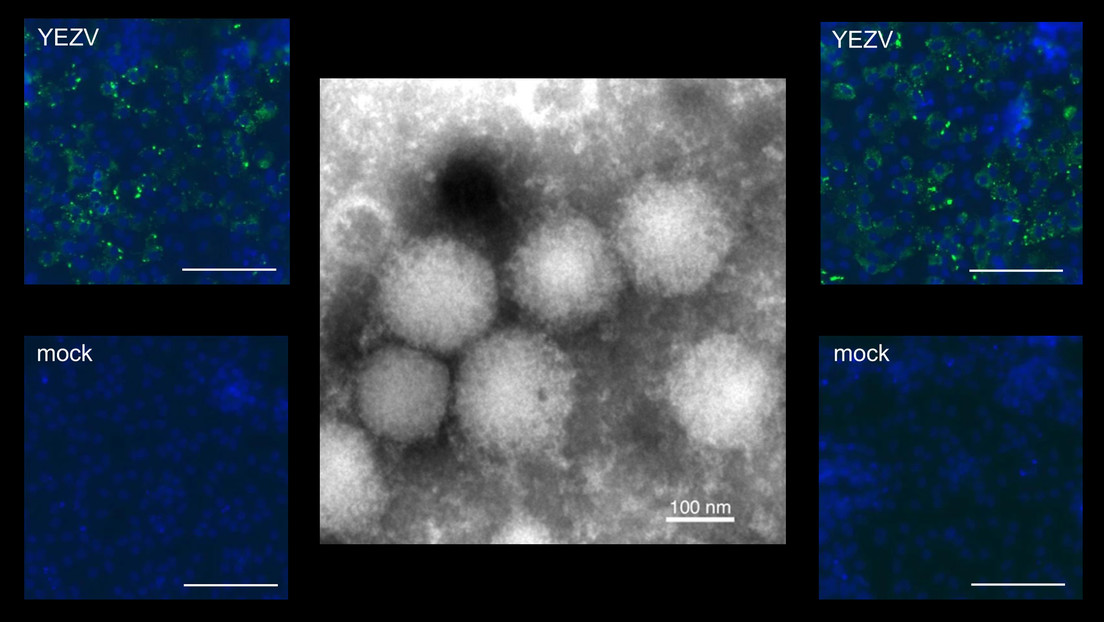 Descubren en Japón un nuevo virus transmitido por garrapatas que puede infectar y causar enfermedades a los seres humanos