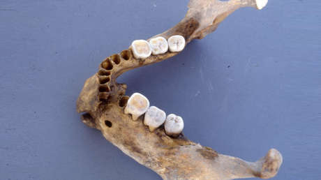 Descubren que un guerrero bizantino del siglo XIV que se rompió la mandíbula en dos fue curado con éxito por un cirujano experto