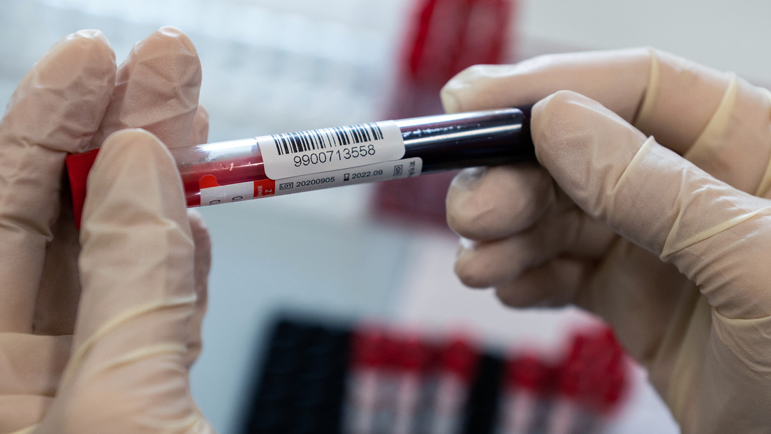 Investigadores argentinos estudian el caso de 'Esperanza', la segunda persona con cura natural del VIH en todo el mundo