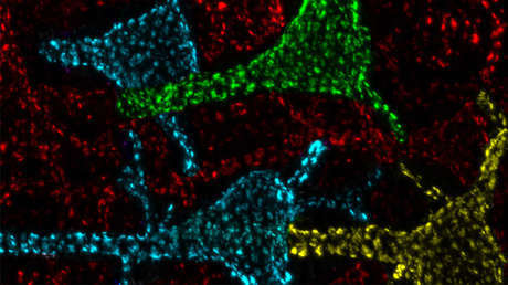 Científicos logran descifrar la función de los misteriosos "puntos calientes" que se encuentran en las neuronas del cerebro