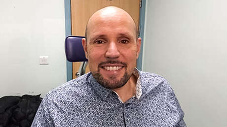 Implantan por primera vez a una persona una prótesis de ojo creada con impresión 3D