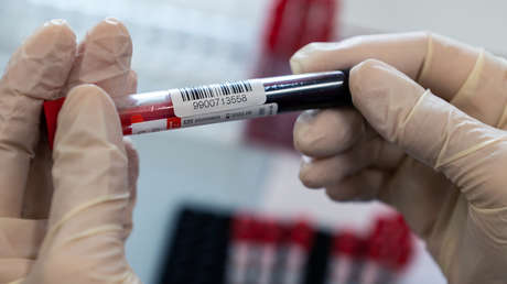 Investigadores argentinos estudian el caso de 'Esperanza', la segunda persona con cura natural del VIH en todo el mundo