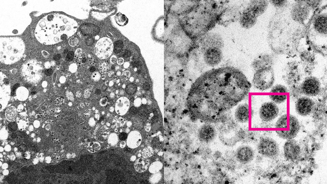 Científicos 'retratan' la variante ómicron de coronavirus