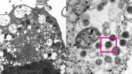 Científicos 'retratan' la variante ómicron de coronavirus