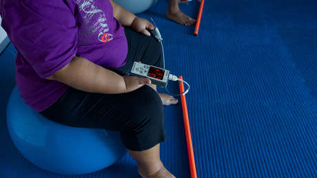 Estudio arroja luz sobre la relación entre obesidad y casos graves de covid-19: el virus podría infectar el tejido graso