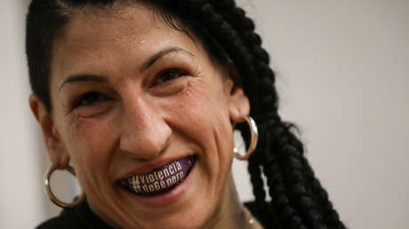 FOTOS: Una boxeadora muestra su cara casi irreconocible tras encajar 236 golpes