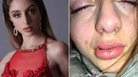 "Fui golpeada salvajemente muchas veces": El duro testimonio de una modelo venezolana que grabó el maltrato de su pareja