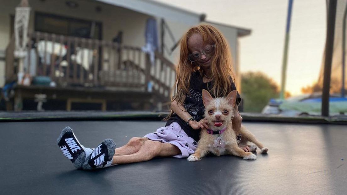 Muere a los 15 años Adalia Rose, la estrella de Internet con envejecimiento prematuro que "conmovió a millones de personas"