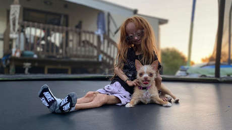 Muere a los 15 años Adalia Rose, la estrella de Internet con envejecimiento prematuro que "conmovió a millones de personas"