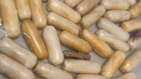 Detienen a un hombre que pasó varios días en coma luego de que se rompiera una de las 57 bolas de cocaína que llevaba en el estómago