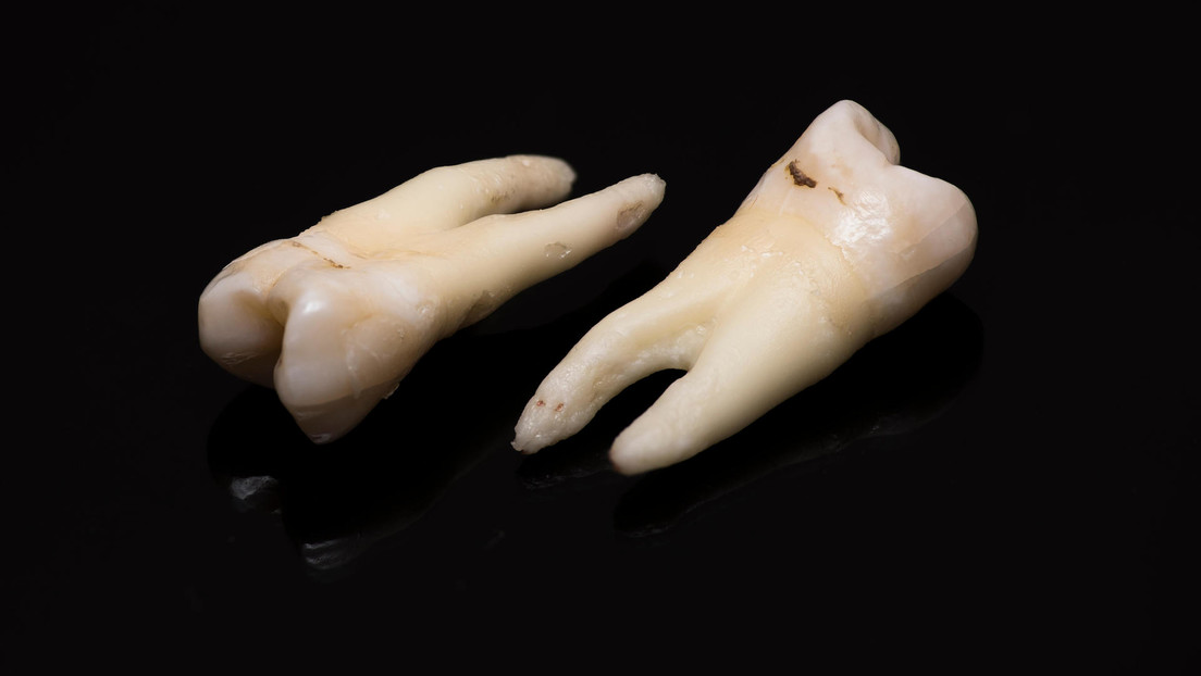 Cientos de dientes humanos caen sobre un hombre durante las reparaciones de una tienda en EE.UU.