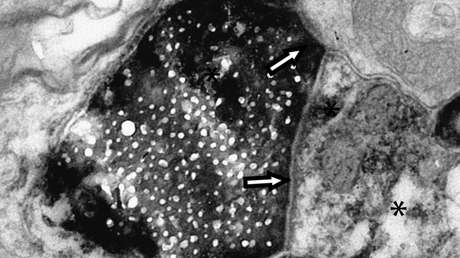 Descubren un nuevo tipo de comunicación celular en el cerebro