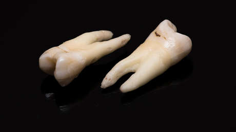 Cientos de dientes humanos caen sobre un hombre durante las reparaciones de una tienda en EE.UU.