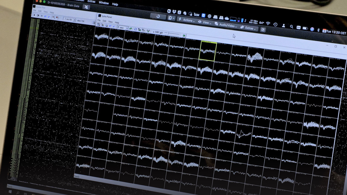 Implantan a un paciente con parálisis total dos chips que le permiten volver a comunicarse con palabras y oraciones completas
