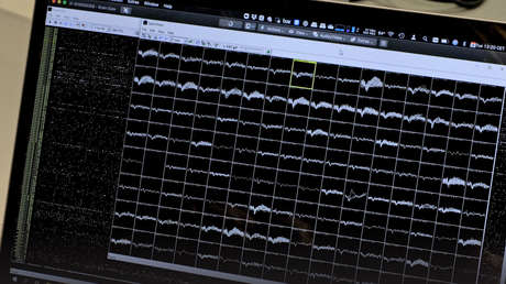 Implantan a un paciente con parálisis total dos chips que le permiten volver a comunicarse con palabras y oraciones completas