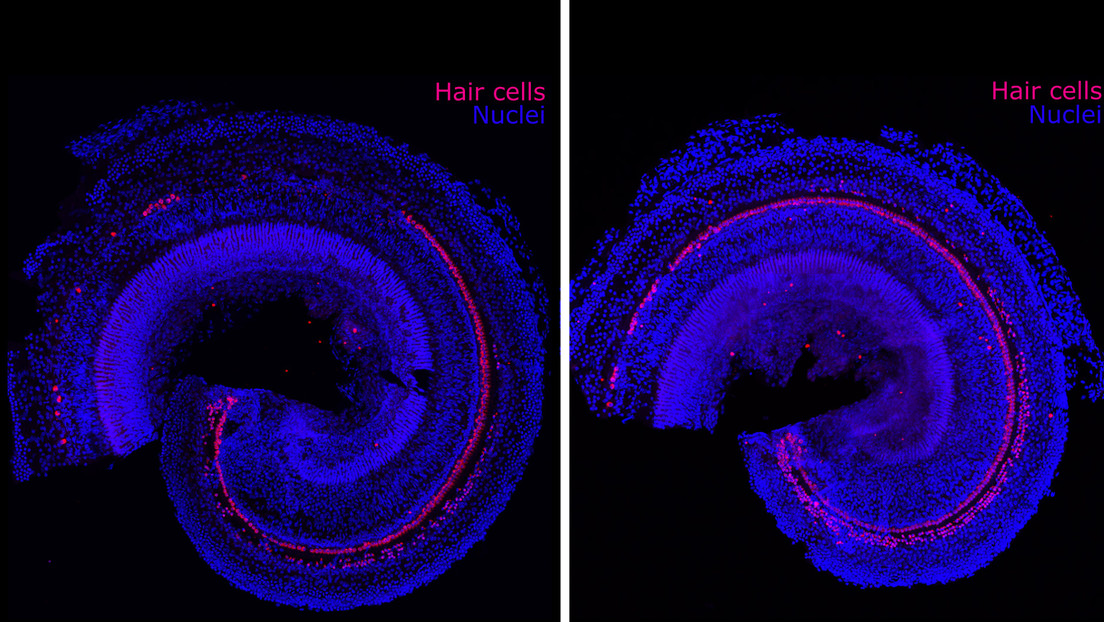 Científicos de Massachusetts encuentran la forma de revertir la pérdida auditiva