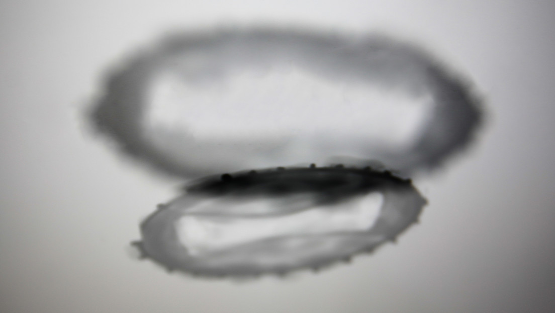 Argentina confirma el primer caso de viruela del mono en América Latina