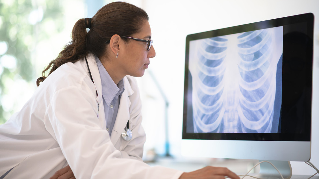 Un nuevo tratamiento en España logra erradicar el cáncer de pulmón en casi un 37 % de los casos