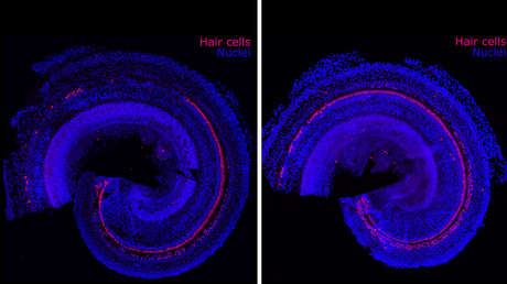 Científicos de Massachusetts encuentran la forma de revertir la pérdida auditiva
