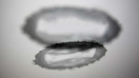 Argentina confirma el primer caso de viruela del mono en América Latina