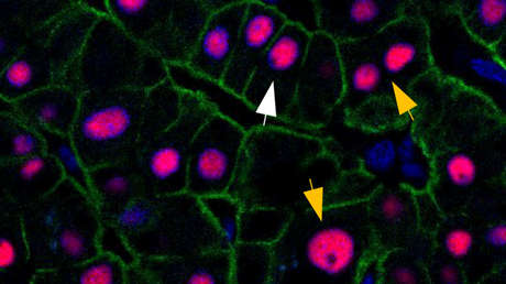 El hígado humano no envejece, a diferencia del resto del cuerpo, y siempre tiene la edad de tres años