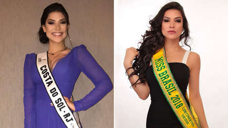 Muere a los 27 años una exreina de belleza brasileña tras una cirugía de amígdalas