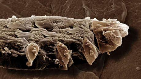 Los ácaros que copulan en nuestra cara por la noche tienen un grave problema