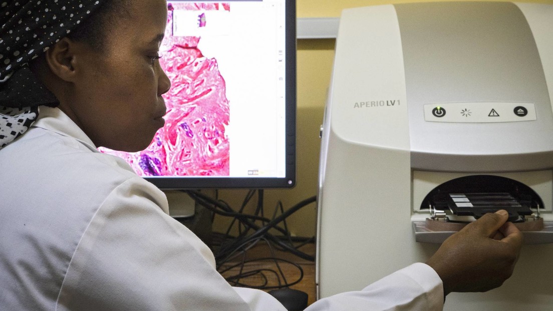 Tres muertos en Tanzania por una enfermedad desconocida que provoca hemorragias nasales