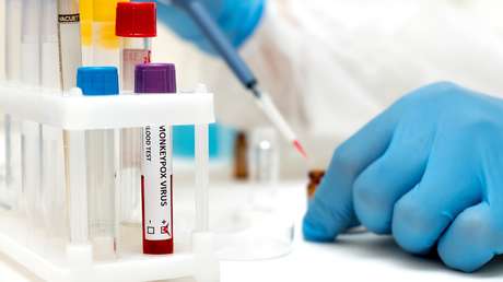 Confirman la primera muerte de un paciente con viruela del mono en Perú