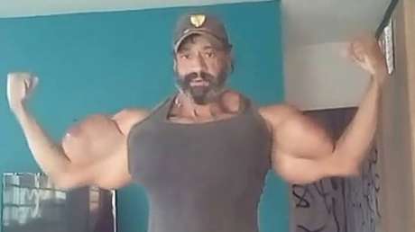 Muere en el día de su cumpleaños el 'Hulk' brasileño que se inyectaba Synthol para inflar los músculos