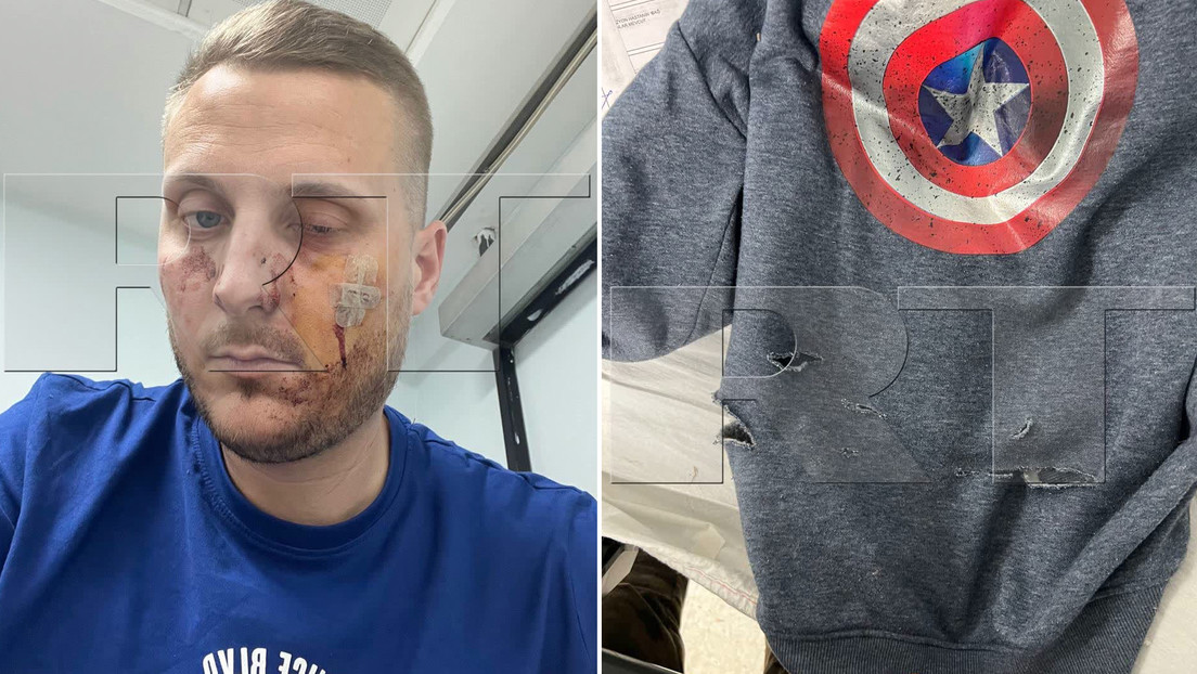 Atacan en Estambul a un voluntario francés que ha estado cubriendo los acontecimientos en Donbass