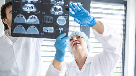 Un aparente 'rasguño hecho por el cepillo de pelo' en la frente de una mujer resulta ser un peligroso cáncer de piel