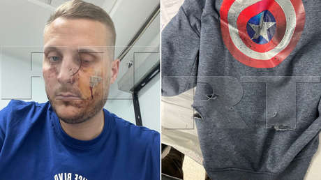 Atacan en Estambul a un voluntario francés que ha estado cubriendo los acontecimientos en Donbass