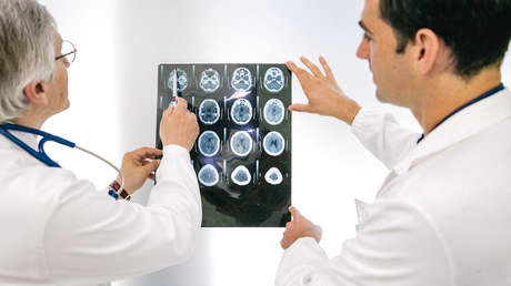 Científicos aprenden a predecir con exactitud el riesgo de un ictus a partir de los genes