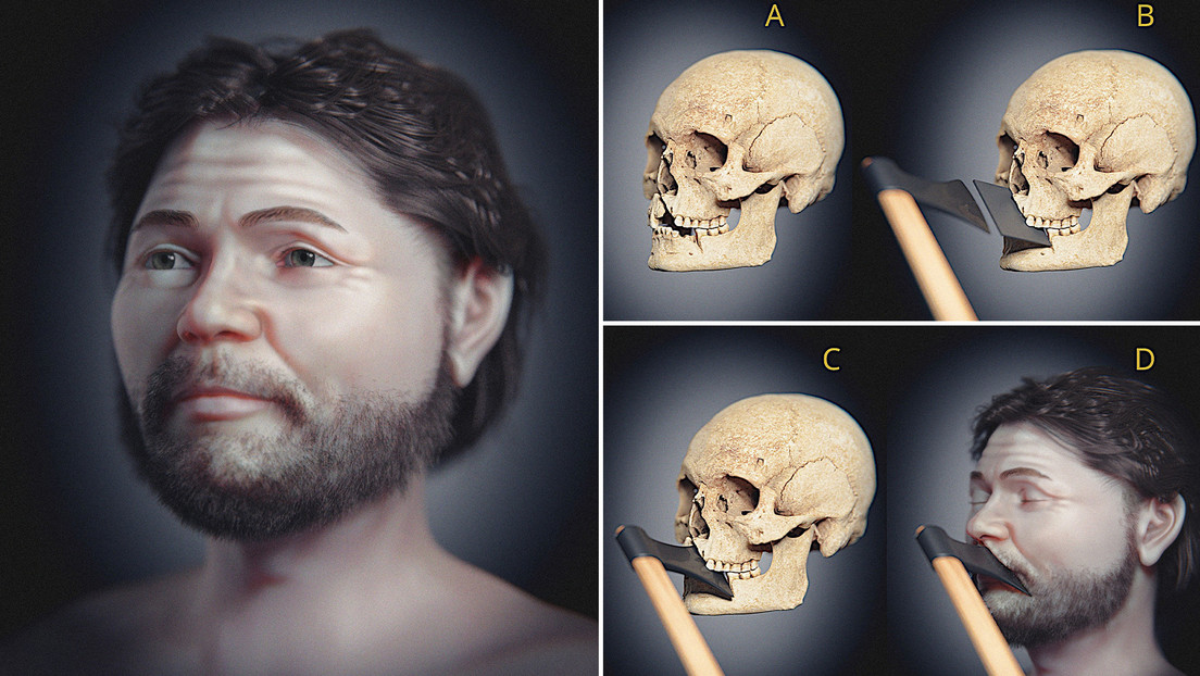Reconstruyen el rostro de un guerrero medieval sueco con una terrible herida