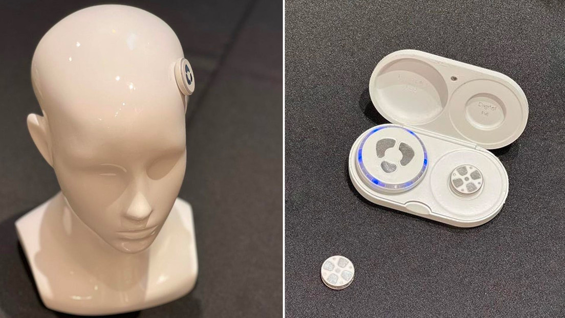 Presentan un innovador implante que  "sin penetrar en el cerebro" promete curar la depresión