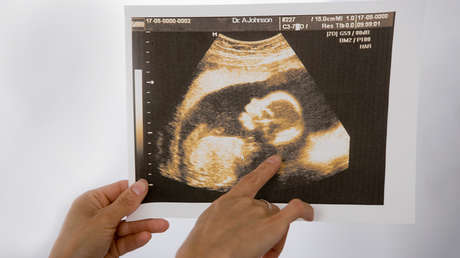 El Colegio de Médicos Colombiano desata la polémica tras sugerir el uso de mujeres con muerte cerebral para gestación subrogada