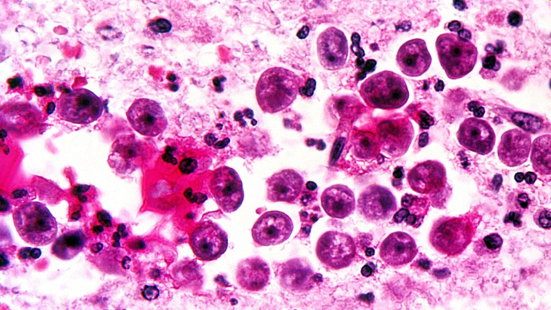 Muere en EE.UU. un hombre por una ameba en el agua del grifo que devoró su cerebro