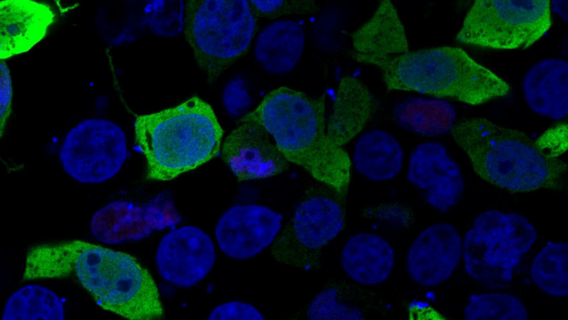Identifican el origen genético de tres enfermedades raras