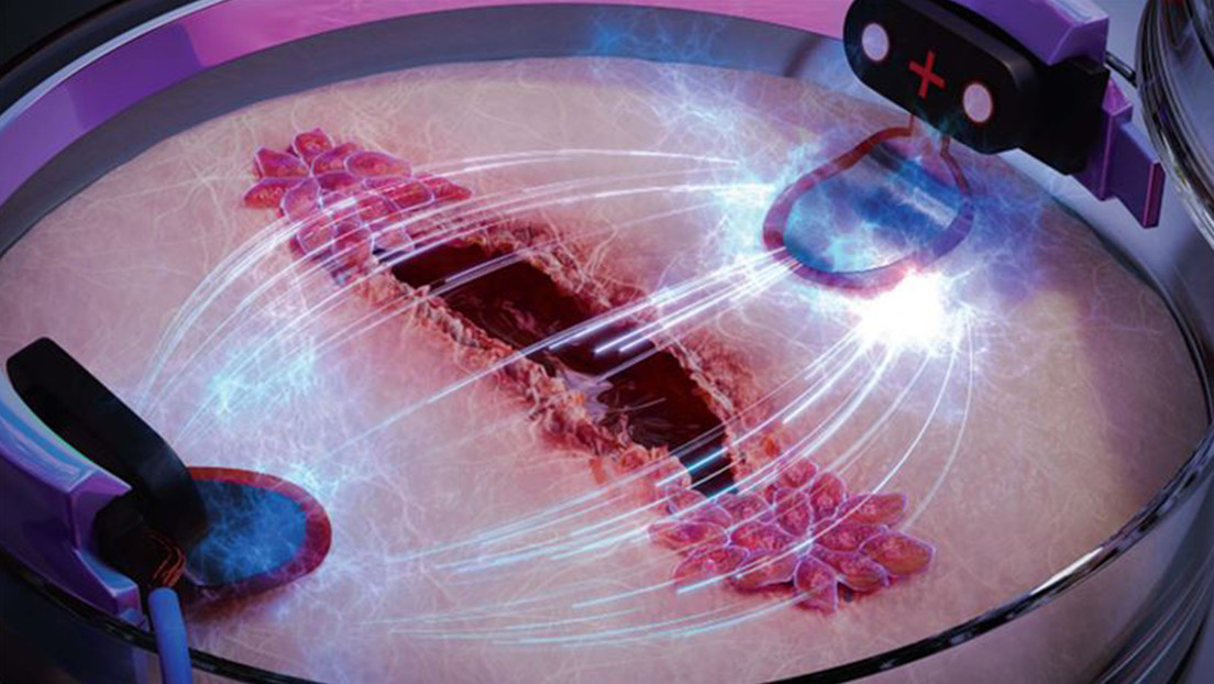 La electricidad podría ayudar a curar las heridas hasta tres veces más rápido