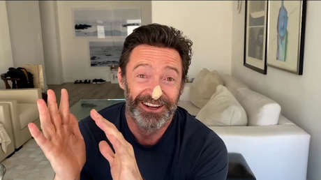 Hugh Jackman se somete a dos biopsias para descartar cáncer de piel