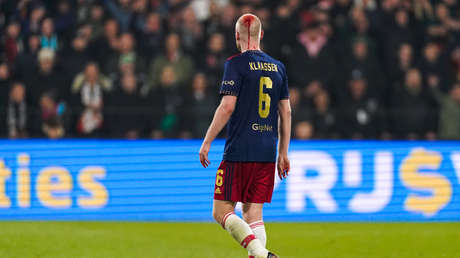 Un futbolista sufre un corte en la cabeza tras ser golpeado por un objeto lanzado desde la tribuna (VIDEO)