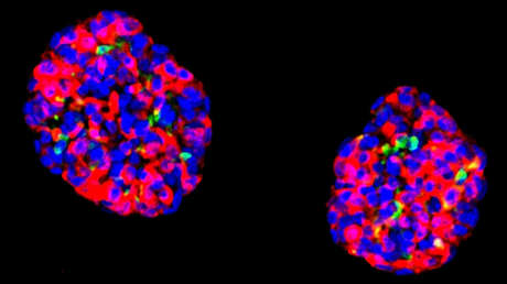Hackean células humanas y las usan para revertir la diabetes en ratones